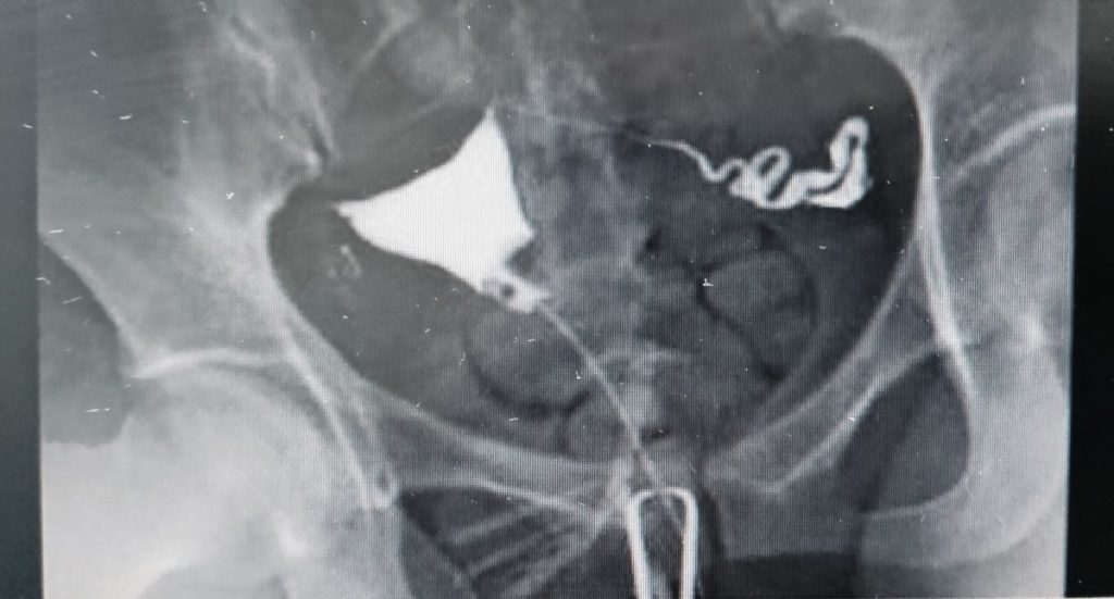 画像に alt 属性が指定されていません。ファイル名: 20210528_162854-1-1024x551.jpg