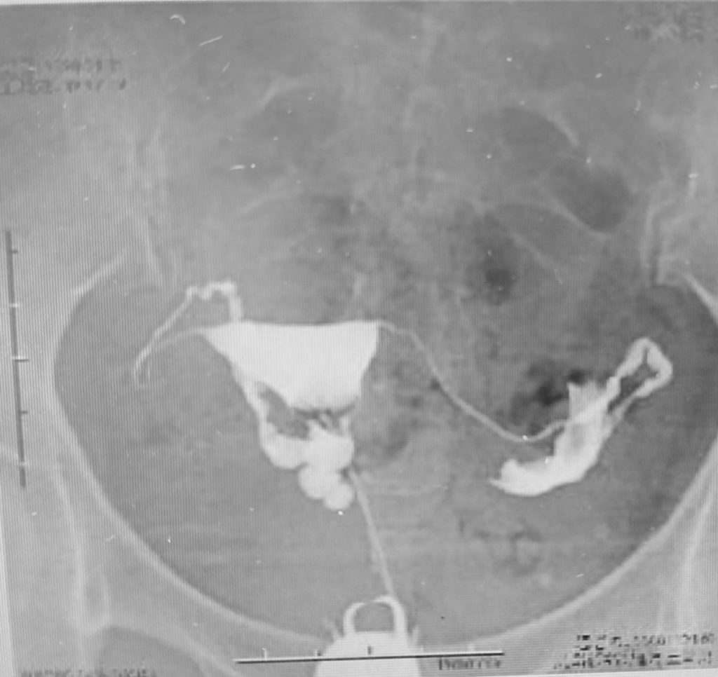 画像に alt 属性が指定されていません。ファイル名: 20210528_164640-1024x966.jpg